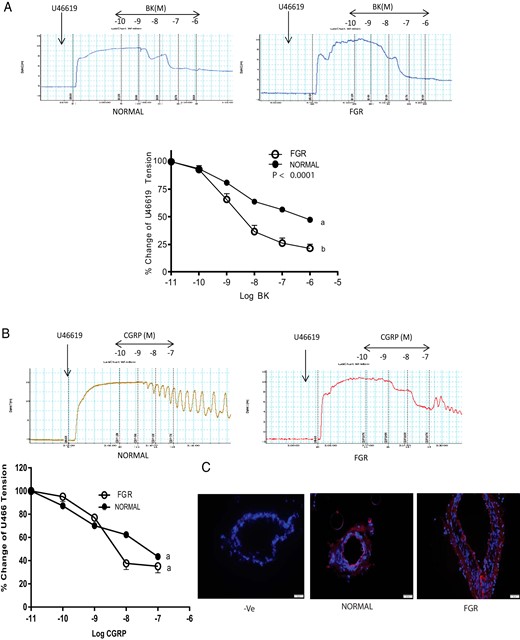 Vascular effects of BK and CGRP on segments of OA precontracted with thromboxane agonist U46619 (1 μM) in FGR pregnancy.