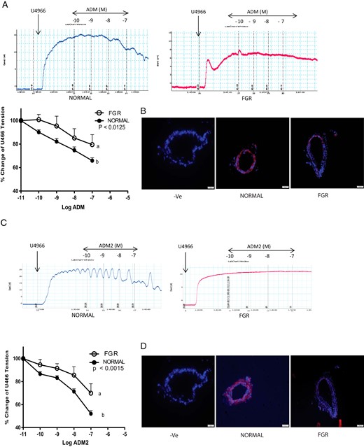 Vascular effects of ADM and ADM2 on segments of OA precontracted with thromboxane agonist U46619 (1 μM) in FGR pregnancy.