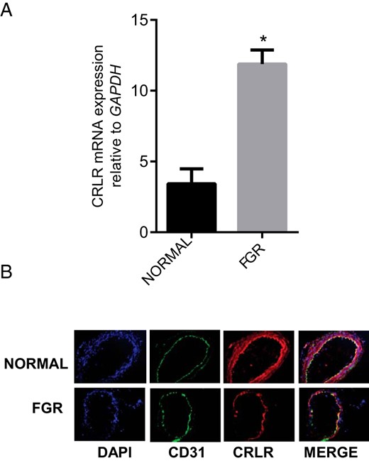Expression of CRLR in OA from normal pregnancy and FGR pregnancy.