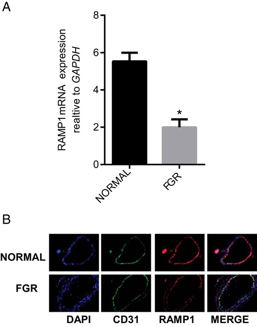 Expression of RAMP1 in OA from normal pregnancy and FGR pregnancy.