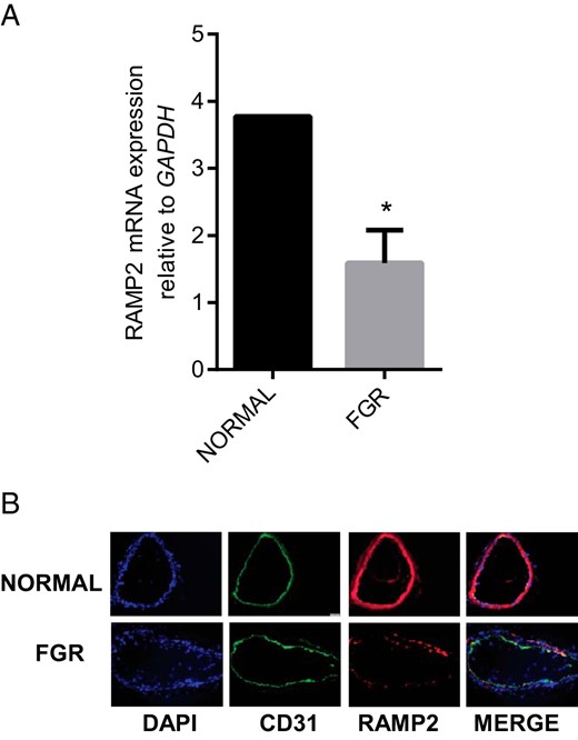 Expression of RAMP2 in OA from normal pregnancy and FGR pregnancy.