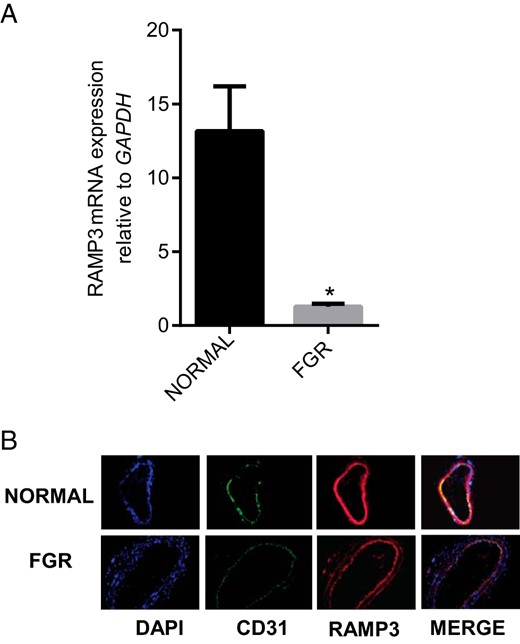 Expression of RAMP3 in OA from normal pregnancy and FGR pregnancy.