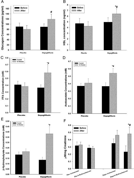 Change in plasma glucagon (A), HSL (B), FFAs (C), acetoacetate (D), β-hydroxybutyrate (E), and urinary ketones (F) in T1D patients on liraglutide and insulin therapy before and after 12 weeks of treatment with dapagliflozin 10 mg (n = 17) or placebo (n = 9).