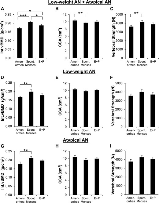 Int.vBMD, CSA, and vertebral strength in AN by current menstrual characteristics. Among all women with low-weight AN and atypical AN combined, (A) Int.vBMD was lowest in those with current amenorrhea (N = 50), highest in those with spontaneous menses currently (N = 34), and intermediate in those receiving E+P currently (N = 24). (B) CSA was higher in AN with current amenorrhea than AN with spontaneous menses currently. (C) Vertebral strength was lower in AN with current amenorrhea compared with AN with spontaneous menses currently. When analyzing the low-weight AN group individually, (D) Int.vBMD was lower in those with current amenorrhea (n = 37) compared with those with spontaneous menses (n = 15) and did not differ from those receiving E+P (n = 12); (E) CSA and (F) vertebral strength did not differ by menstrual characteristics. The same pattern was seen in the atypical AN group individually; (G) Int.vBMD was lower in atypical AN subjects who had current amenorrhea (n = 13) compared with those with spontaneous menses (n = 19) and did not differ from those receiving E+P (n = 12), and (H) CSA and (I) vertebral strength did not differ by menstrual characteristics. Results are reported as means ±SEM. Amenorrhea, current amenorrhea; Spont. Menses, spontaneous menses currently; E+P, receiving systemically absorbed E+P currently. *P < 0.04; **P < 0.01; ***P < 0.0001.