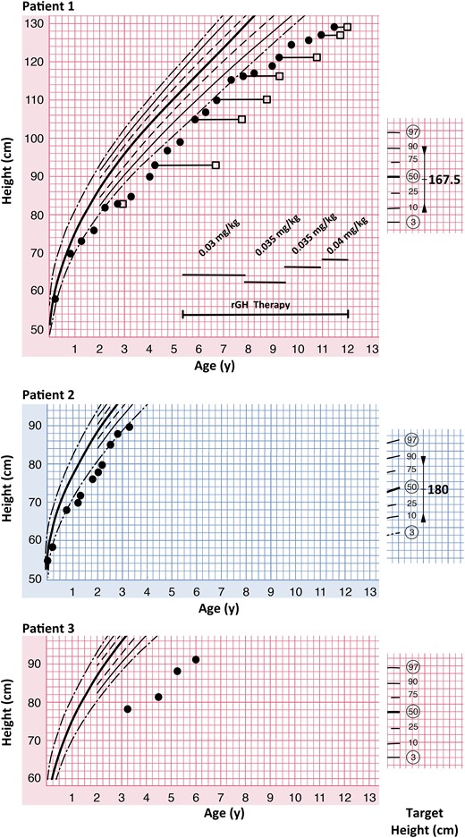 Growth is impaired in patients with JPD. Patient 1 is displaying growth (closed circles) below the 3rd percentile and was found to be GH deficient. Treatment with recombinant GH (rGH) was commenced at 5 years 4 months of age and initially resulted in growth along the 3rd percentile. At age 9 years, growth velocity deteriorated despite adjustment of the GH doses. The bone age (open squares) was initially advanced, but is almost age appropriate at age 11 years 6 months. Patient 2 is growing just below the 3rd percentile. He has a confirmed diagnosis of GH deficiency but is not treated with GH so far. Patient 3 is growing well below the 3rd percentile, despite normal IGF 1 serum levels. She has not been tested for GH deficiency.