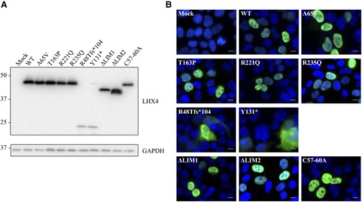 Expression analysis of HA-tagged wild-type (WT) and mutant LHX4 proteins expressed in HEK293T. (A) Protein expression level was assessed by western blotting using a monoclonal anti-HA antibody. Glyceraldehyde 3-phosphate dehydrogenase (GAPDH) was used as a loading control. Molecular weights are indicated in kDa. (B) Subcellular localization of LHX4 WT and missense variants, as visualized by immunocytofluorescence. Putative truncated proteins corresponding to p.(Arg48Thrfs*104) and p.(Tyr131*) display an abnormal cytoplasmic localization. Other variants are expressed in the nucleus. HA-tagged LHX4 (green); DAPI (blue). White bar is 15 µm.