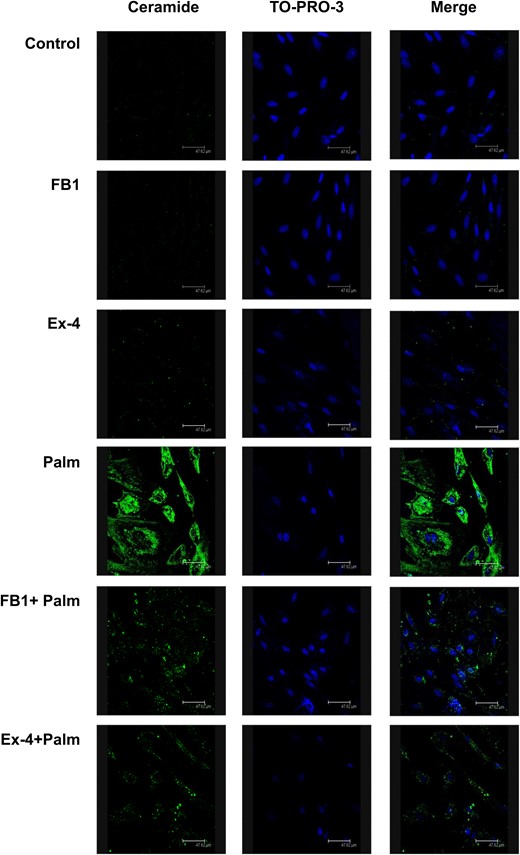 Effects of FB1 and exendin-4 on the intracellular content of ceramide in CPCs exposed to palmitate. Human CPCs were preincubated with 20 nmol/L exendin-4 for 8 hours, or 20 µmol/L FB1 for 8 hours, or left untreated, and then exposed to 0.25 mmol/L palmitate for 16 hours. Cells were then fixed and incubated with a ceramide antibody followed by Alexa Fluor (488) anti-rabbit antibody (green) to stain ceramide. TO-PRO-3 was used to stain nuclei (blue). Scale bar, 47.62 µm. Ex-4, exendin-4; Palm, palmitate.