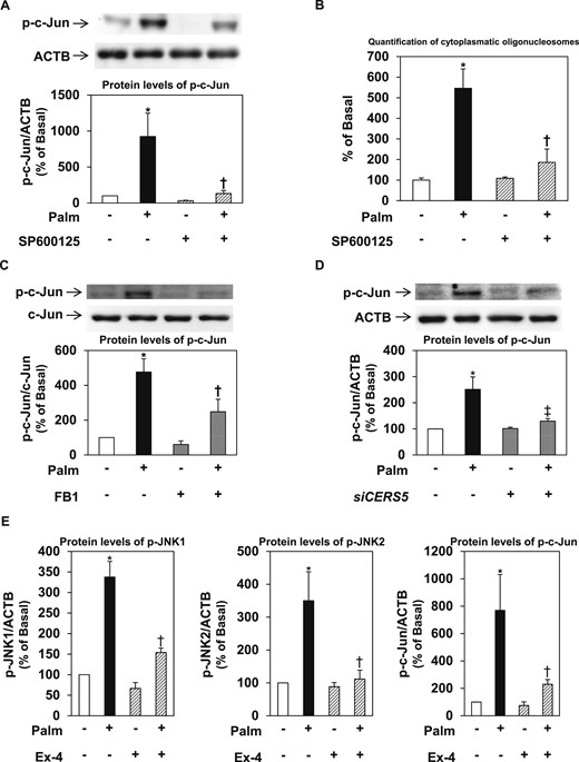The JNK signaling pathway mediates the proapoptotic effects of palmitate, is activated by the ceramide biosynthetic pathway, and is inhibited by exendin-4. (A, B) Effects of JNK inhibition on palmitate-induced c-Jun phosphorylation and apoptosis. Human CPCs were treated with 20 µmol/L SP600125 for 1 hour and then exposed to palmitate for 16 hours. (A) Phosphorylation of c-Jun was evaluated by immunoblotting and (B) apoptosis by enzyme-linked immunosorbent assay for cytoplasmic oligonucleosomes. *P < 0.05 vs basal (no palmitate); †P < 0.05 vs cells not treated with SP600125. (C, D) Effects of ceramide synthase inhibition on palmitate-induced c-Jun phosphorylation. CPCs were pretreated with (C) 20 µmol/L FB1 for 8 hours or transfected with (D) 20 µmol/L siRNA specific to CERS5 for 24 hours, or left untreated, and then exposed to 0.25 mmol/L palmitate for 16 hours. Representative immunoblots and quantitation of c-Jun protein content and phosphorylation from at least three independent experiments are shown. *P < 0.05 vs basal (no palmitate); †P < 0.05 vs cells not treated with FB1; ‡P < 0.05 vs cells not transfected with siCERS5. (E) Effects of exendin-4 on the activation of the JNK pathway by palmitate. Human CPCs were incubated in the presence of 20 nmol/L exendin-4 for 8 hours, or left untreated, and then exposed to 0.25 mmol/L palmitate for 16 hours. The panels show the quantitation of JNK1, JNK2, and c-Jun phosphorylation. All data are presented as mean ± standard error of the mean of at least three experiments, which were carried out using cells from different human donors; *P < 0.05 vs basal (no palmitate); †P < 0.05 vs cells not treated with exendin-4. Ex-4, exendin4; p-JNK, phospho-JNK; Palm, palmitate;siCERS5, siRNA to CERS5.