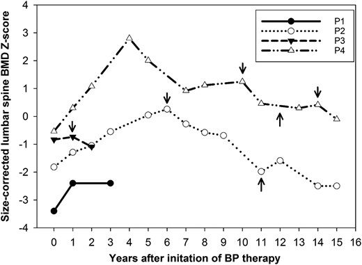 Age-, sex-, and size-adjusted lumbar spine BMD z scores in response to BP therapy in patients 1–4. BMAD z scores are used for patients measured on Lunar scanners and HAZ for patients on Hologic scanners. Arrows pointing downward indicate treatment discontinuation; arrows pointing upward indicate treatment restart. For details on dose and choice of BP therapy, refer to the text. P, patient.