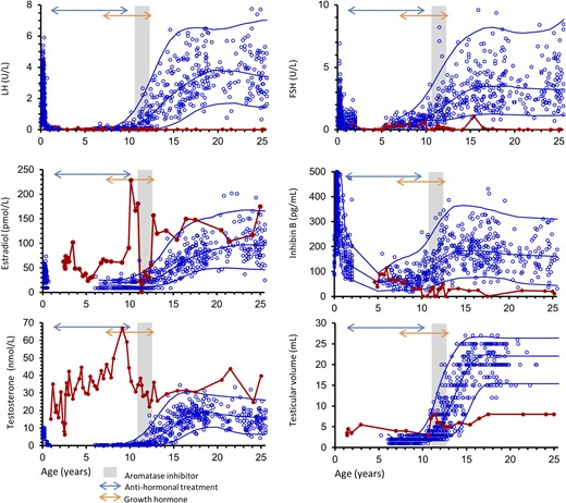 Longitudinal serum concentrations of LH, FSH, estradiol, inhibin B, and testosterone as well as testicular volume measured by orchidometer (red line) are shown according to age and reference ranges based on healthy male children, adolescents, and adults (blue dots). Blue lines represent mean ± 2 standard deviation. Antihormonal and growth hormone treatments are indicated with arrows, and the time period with aromatase inhibition is illustrated by the gray shaded area. Antihormonal treatment included various combinations of GnRH agonist, medroxyprogesterone acetate, cyproterone acetate, testolactone, and tamoxifen.