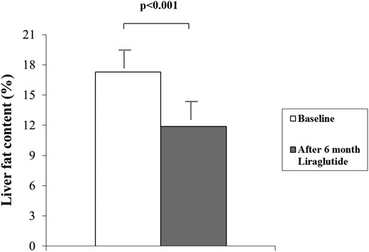 Liver fat content in patients with type 2 diabetes before and 6 months after the initiation of liraglutide treatment.