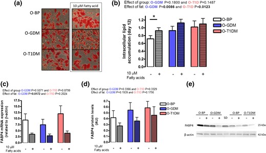 Adipocyte lipid accumulation. Preadipocytes from O-BP (n = 18), O-GDM (n = 18), and O-T1DM (n = 16) were cultured until maturity on day 12; in the final 3 days of differentiation, the cultured adipocytes were supplied with either vehicle or 10 µM fatty acids. (a) Pictures of intracellular lipid content by Oil Red O staining. (b) Estimation of intracellular lipid content. (c) FABP4 mRNA expression. (d) FABP4 protein levels. (e) Representative Western blot of FABP and β-actin. Hatched bars indicate 10 μM fatty acid supply. Data are shown as mean ± SEM. The fat and group effect was analyzed by repeated ANOVA. *P < 0.05 (t test).