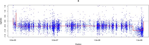 LRR plot for patient 1 who had TS with known 45,X/46,XX mosaicism. The mean LRR (red line) was −0.56, corresponding to approximately 64% 45,X and 36% 46,XX. Note full 100% monosomy for distal Xq, confirmed on microarray.