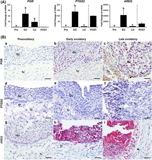 hCG increases the expression of PGR, PTGS2, and AREG in human periovulatory follicles. Dominant follicles were retrieved from the ovaries of women undergoing laparoscopic tubal sterilization before the LH surge or at defined hours after hCG administration and divided into four phases: pre- (Pre, n = 6), early (EO, n = 5), late (LO, n = 6), and post- (POST, n = 2) ovulatory phases as described in the Materials and Methods section. (A) The levels of mRNA for each transcript were measured by quantitative PCR in granulosa cells isolated from a dominant follicle collected at Pre, EO, and LO and whole follicles retrieved at POST and normalized to the levels of GAPDH mRNA in each sample. The levels of transcript were presented as fold change to Pre levels. Bars with no common superscripts are significantly different (P < 0.05). (B) Paraffin-embedded sections (7 µm) of dominant follicles were subjected to immunohistochemical analyses to detect PGR, PTGS2, and AREG. Pink/purple staining represents positive signals for PGR, PTGS2, and AREG protein. Arrows indicate red blood cells. Scale bar, 100 µm for all images. Gc, granulosa cells; Tc, theca cells.