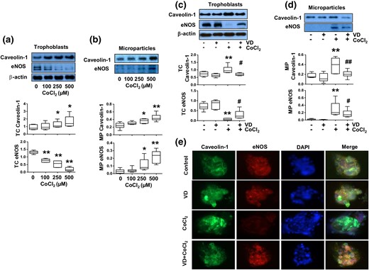 Effects of 1,25(OH)2D3 (VD) on altered caveolin-1 and eNOS expression induced by CoCl2 in trophoblasts and trophoblast-derived MPs. Trophoblasts from uncomplicated pregnancies were used. (a) Protein expression for caveolin-1 and eNOS in trophoblasts treated with different concentrations of CoCl2. The box and whisker plots show relative protein expression after being normalized against β actin from six independent experiments. CoCl2 induced a dose-dependent increase in caveolin-1 expression, but a dose-dependent decrease in eNOS expression in trophoblasts. *P < 0.05; **P < 0.01 (treated versus control cells). (b) Protein expression for caveolin-1 and eNOS in trophoblast-derived MPs from cells treated with different concentrations of CoCl2. The box and whisker plots show relative protein expression after being normalized by total cellular protein per well. MP expression of caveolin-1 and eNOS were dose-dependent increased in cells treated with CoCl2. *P < 0.05; **P < 0.01. (c) Caveolin-1 and eNOS expression in trophoblast cells treated with CoCl2 in the presence or absence of 1,25(OH)2D3. VD prevented CoCl2-induced increased caveolin-1 expression and decreased eNOS expression in trophoblasts. The box and whisker plots show relative protein expression after being normalized against β actin. **P < 0.01 (CoCl2 treated versus control); #P < 0.05 (VD + CoCl2 versus CoCl2 treated). (d) Expression of caveolin-1 and eNOS in trophoblast-derived MPs in cells treated with CoCl2 in the presence or absence of 1,25(OH)2D3. The increased MP caveolin-1 and eNOS expression induced by CoCl2 was reduced when cells were treated with VD. The box and whisker plots show relative protein expression after being adjusted by total cellular protein per well from 6 independent experiments. **P < 0.01 (CoCl2 treated versus control); #P < 0.05 and ##P < 0.01 (VD + CoCl2 versus CoCl2 treated). (e) Representative imaging of immunofluorescent staining of caveolin-1 and eNOS in trophoblasts treated with CoCl2 in the presence or absence of 1,25(OH)2D3. Consistent with Western blot results, VD could inhibit CoCl2-induced increased caveolin-1 expression and decreased eNOS expression in placental trophoblasts.