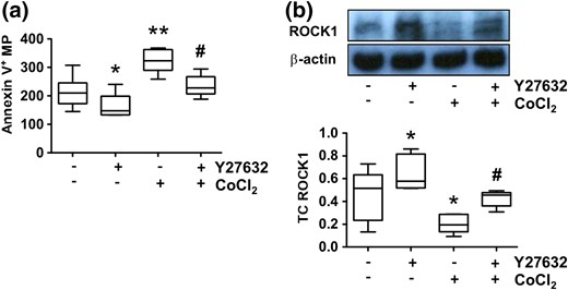Effects of ROCK1 inhibitor on MP release and ROCK1 expression by placental trophoblasts. Trophoblasts from uncomplicated pregnancies were used. (a) Effects of ROCK1 inhibitor Y27632 on trophoblast MP shedding. Trophoblasts were treated with CoCl2 in the presence or absence of Y27632. Annexin V+ MPs were assessed by flow cytometry, and MP counts were normalized by total cellular protein. Cells treated with Y27632 released significantly less annexin V+ MPs in both control cells and in cells treated with CoCl2. *P < 0.05 and **P < 0.01 (treated versus control); #P < 0.05 (Y27632 + CoCl2 versus CoCl2 alone). (b) ROCK1 expression in trophoblasts treated with CoCl2 in the presence or absence of Y27632. The box and whisker plots show relative expression after being normalized with β-actin expression in each sample. Y27632 could preserve ROCK1 expression in trophoblasts. *P < 0.05 (treated versus control); #P < 0.05 (Y27632 + CoCl2 versus CoCl2 treated alone). Data are from six independent experiments. Increased ROCK1 expression was correlated with reduced MP release in Y27632-treated cells with or without CoCl2 treatment.