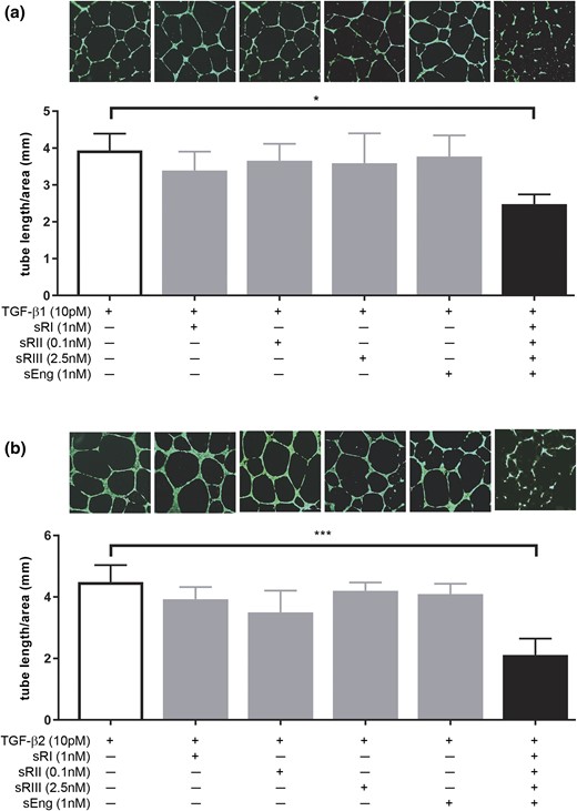 Effect of soluble TGF-β receptors on TGF-β–mediated angiogenesis. HUVECs were cultured in Matrigel and treated with 10 pM TGF-β ligands without or with individual or combined soluble receptors at the highest concentration observed in PE serum. (a) Effect of soluble TGF-β receptors on TGF-β1–mediated tube formation. The bar graph shows the total tube length per square millimeter area for each treatment condition; each bar represents the average tube length calculated from three independent experiments (n = 3). The photograph above each bar is a representative image of that condition. (b) Effect of soluble TGF-β receptors on TGF-β2–mediated tube formation. Data are presented as mean ± standard deviation. *P < 0.05 and ***P < 0.001. sEng, soluble endoglin; sRI, soluble TGFβRI; sRII, soluble TGFβRII; sRIII, soluble TGFβRIII.