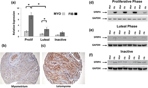 Characterization of sFRP4 expression in specimens of myometrium and leiomyoma. (a) Relative expression of sFRP4 transcript evaluated by RT-qPCR with total RNA prepared from specimens of myometrium (MYO) and leiomyoma (FIB) collected from the proliferative (Prolif) (n = 10), luteal (n = 9), or menopausal (inactive) women (n = 7). All results are reported as relative expression normalized to GAPDH expression with standard errors of the mean (*P < 0.01). Expression of sFRP4 protein was also evaluated by Western blot with total protein prepared from matched specimens of myometrium (Myo) and leiomyomas (Fib) collected during (d) proliferative or (e) luteal phase of the menstrual cycle or from (f) postmenopausal women (inactive). Immunohistochemical evaluation of sFPR4 expression in representative luteal phase specimens of (b) myometrium and (c) leiomyoma. All images at ×40 magnification.