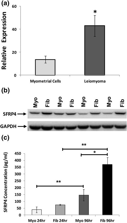 Characterization of sFRP4 expression in primary cultures derived from specimens of myometrium and leiomyoma. (a) Expression of sFRP4 transcript evaluated with RT-qPCR, with results reported as relative fold-levels of expression with standard errors of the mean. (b) sFRP4 expression evaluated in specimens of myometrium (Myo) and leiomyoma (Fib) by Western blot. (c) Evaluation of spent media for secreted sFRP4 by enzyme-linked immunosorbent assay. Media were aspirated from primary cultures of either myometrium or leiomyomas after 24 or 96 hours. (*P ≤ 0.001; **P ≤ 0.01).