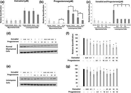 Impact of estrogen and progesterone treatment on sFRP4 expression in vitro. (a–c) Primary cultures derived from myometrium or leiomyoma were incubated with vehicle alone or doses of estradiol (E2), progesterone (P4), or combinations of estrogen and progesterone across a range of doses as specified. Expression of sFRP4 transcript, normalized to GAPDH, was then evaluated by RT-qPCR. Results are reported as relative fold-levels of expression with standard errors of the mean (*P = 0.05; **P < 0.01). sFRP4 expression was also evaluated in primary cultures (n = 3) of (d) myometrium and (e) leiomyoma cells after treatment with media supplemented with estradiol, progesterone, or estradiol plus progesterone by Western blot. Expression of GAPDH was used as a loading control. (f, g) Relative quantification of Western blots performed to evaluate impact of increasing micromolar concentrations of estradiol and progesterone on sFRP4 expression in primary cultures of myometrium (n = 3) and leiomyoma (n = 3) (*P < 0.05 when compared with cultures treated with vehicle alone). For all panels, doses of estradiol and progesterone are specified as micromolar (μM) concentrations at final dilution.