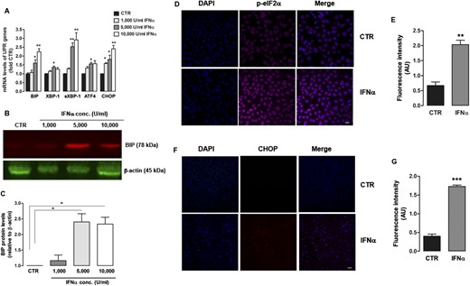 IFNα induces UPR activation in human thyroid cells. (A) mRNA expression of UPR genes BIP, XBP-1, sXBP-1, ATF4, CHOP measured by quantitative RT-PCR in ML-1 cells exposed to increasing doses of IFNα (1000, 5000, and 10,000 U/mL) for 48 h. The data were normalized for each mRNA level relative to the CTR group. (B) Representative immunoblot of BIP (78 kDa) and β-actin (45 kDa) of ML-1 cells treated with the same increasing doses of IFNα as in (A) for 48 h and (C) a respective analysis by densitometry. (D) Immunofluorescence staining for DAPI (blue) and pelF2α (purple) in ML-1 cells treated with IFNα (5000 U/mL) for 48 h and (E) a respective quantification of fluorescence signal intensity. (F) Immunofluorescence staining for DAPI (blue) and CHOP (red) in cells treated with IFNα (5000 U/mL) for 48 h and (G) a respective quantification of fluorescence signal intensity. Scale bars, 10 μm. The data are shown as mean ± SE of at least three independent experiments. Statistical analysis was performed using one-way ANOVA followed by Student-Newman-Keuls multiple comparison test. *P < 0.05, **P < 0.01, *** P < 0.001 vs CTR cells. Conc, concentration; CTR, control; DAPI, 4′,6-diamidino-2-phenylindole.