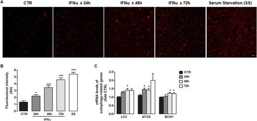 IFNα induces autophagy markers. (A) Representative immunofluorescence images after LysoTracker staining for lysosomes in ML-1 cells treated with IFNα (5000 U/mL) for 24, 48, and 72 h, and cells under serum starvation for 16 to 18 h. Scale bar, 10 μm. (B) Respective quantification of fluorescence signal intensity. (C) mRNA expression of autophagy genes LC3, ATG5, and beclin 1 measured by quantitative RT-PCR in ML-1 cells exposed to 5000 U/mL IFNα for 24, 48, and 72 h. Data are shown as mean ± SE of at least three independent experiments. Statistical analysis was performed using one-way ANOVA followed by Student-Newman-Keuls multiple comparison test. *P < 0.05, *** P < 0.001 vs CTR cells. AU, arbitrary units; CTR, control.