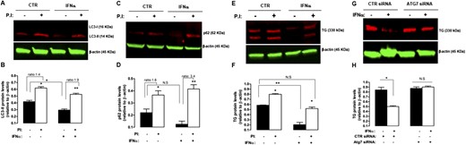 Blockage of lysosomal degradation and autophagy prevented IFNα-induced protein degradation of TG. (A) Representative immunoblot of p62 (62 kDa) and β-actin (45 kDa) and (B) corresponding densitometric analysis showing increased p62 protein expression levels in ML-1 cells treated with IFNα (5000 U/mL) for 48 h, followed by protease inhibitors (to block lysosomal degradation). (C) Representative immunoblot of LC3-II (14 kDa) and β-actin (45 kDa) and (D) corresponding densitometric analysis showing increased LC3-II expression levels in ML-1 cells treated with IFNα (5000 U/mL) for 48 h, followed by PIs (to block lysosomal degradation). Note that LC3-I (16 kDa) levels were not detected. (E) Representative immunoblot of TG (330 kDa) and β-actin (45 kDa) and (F) corresponding densitometric analysis showing blockage of TG degradation in ML-1 cells treated with IFNα (5000 U/mL) for 48 h, followed by blockage of lysosomal degradation by PIs. Where indicated, a combination of lysosomal protease inhibitors (20 mM NH4Cl and 200 µM leupeptin) was added 12 h before collecting the cells (see Methods). (G) Representative immunoblot of TG (330 kDa) and β-actin (45 kDa) and (H) corresponding densitometric analysis showing blockage of TG degradation in ML-1 cells treated with IFNα (5000 U/mL) for 48 h after small-interfering RNA–mediated Atg7 knockdown. Data are shown as mean ± SE of at least three independent experiments. Statistical analysis was performed using Student t test. *P < 0.05, **P < 0.01. CTR, control; N.S, nonsignificant; PI, protease inhibitor.