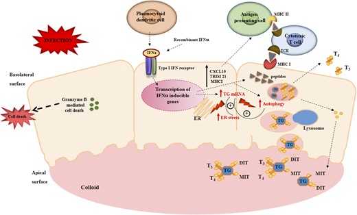 Potential mechanisms by which IFNα disrupts thyrocytes to trigger AITDs. Thyroid follicles are composed of a monolayer of polarized thyroid follicular cells with the apical surface facing the interior of the follicle containing the colloid and the basolateral surface facing the blood vessels. TG is stored in the colloid; upon TSH stimulation of the thyroid-stimulating hormone receptor, TG is endocytosed and processed in lysosomes to release T3 and T4 into the blood. In response to infection, plasmocytoid dendritic cells and other cells produce locally IFNα, which binds to its receptor and activates the JAK/STAT pathway (this would also happen in individuals receiving therapeutic IFNα). The activation of the JAK/STAT pathway results in the stimulation of proinflammatory cytokines, increased expression of HLA class I on thyrocytes, and activation of cytotoxic T cells. In addition, IFNα also triggers TG mRNA upregulation as well as ER stress and autophagic proteolysis, leading to processing of TG by lysosomal hydrolases into immunogenic peptides. Induction of ER stress and autophagy stimulates intrathyroidal expression of IFNα and its target genes, initiating a vicious cycle of stressed thyrocytes that provoke an autoimmune attack. In genetically susceptible individuals (e.g., individuals carrying the TG SNP (−1623A→G), these peptides generated from TG will be presented to T cells and activate self-reactive T cells, triggering thyroid autoimmunity. CXCL10, C-X-C motif chemokine ligand 10; DIT, diodotyrosine; MHC I, major histocompatibility complex I; MHC II, major histocompatibility complex II; MIT, monoiodotyrosine; T3, triiodothyronine; T4, thyroxine; TCR, T-cell receptor; TRIM21, tripartite motif containing 21.