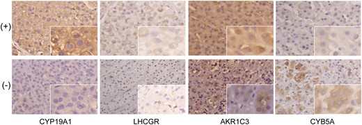 Immunohistochemical staining of steroidogenic tissue-specific enzymes in ACCs. Magnification ×200; insets ×400.