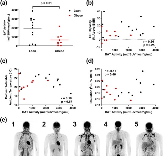 BAT activity measurement by 18F-FDG PET/CT. (a) BAT activity is greater in lean subjects (black, n = 12) than subjects with obesity (red, n = 9). (b–d) BAT activity is not correlated with (b) capacity of CIT, (c) coldest tolerable temperature, or (d) insulation. (e) Examples of PET/CT scans demonstrating variable 18F-FDG uptake by BAT and skeletal muscle in lean subjects (1–3) and subjects with obesity (4 and 5). In subject 1, note the lack of BAT 18F-FDG uptake despite 18F-FDG signal in muscle, indicative of shivering.