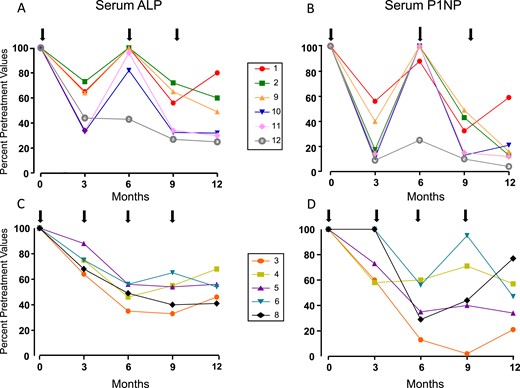 (A–D) Percentage changes in serum ALP and P1NP levels with subcutaneous injections of 60 mg of denosumab (black arrows) in 12 patients with FD/MAS. Normal ranges: ALP 40 to 98 IU/L and P1NP <59 ng/mL. Percentage changes consistently show the different trend in changes in BTMs with denosumab given at 6-mo intervals compared with 3-mo intervals. Patients with 6-mo schedules clearly show an initial decrease in bone turnover after 3 mo, with values of ALP and P1NP returning to baseline after 6 mo. Patients with 3-mo schedules show a similar decrease after 3 mo, but further decrease of ALP and P1NP levels after 6-mo of treatment. Numbers in boxes correspond to individual patient numbers shown in Table 1.