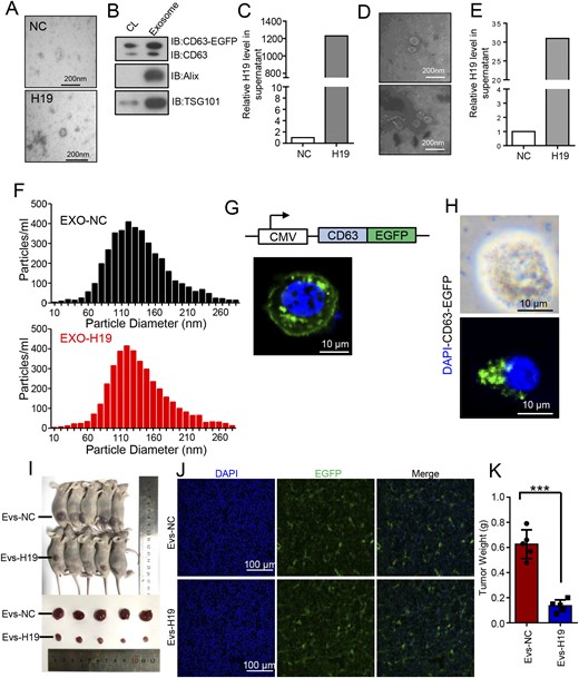 Exosomes serve as the medium for H19 to achieve transmembrane transport and exert its inhibitory effect. (A) Representative TEM images of GH3- and H19-overexpressing GH3 cells from exosomes (scale bars, 200 nm). (B) Detection of exosomal markers CD63, Alix, and TSG101 in GH3 cells and cell supernatant by Western blot analysis. (C) Exosomes were extracted from normal GH3- and H19-overexpression media by ultracentrifugation, from which total RNA was extracted to measure H19 RNA by qRT-PCR and normalized to β-actin. ***P < 0.0001. (D) Whole blood was drawn from nude mice of two groups in Fig. 1 and transferred to the EDTA coagulation-promoting tube and centrifuged at 3000 rpm for 10 min to extract the plasma. Representative images of the exosomes in the two groups were analyzed by TEM (scale bars, 200 nm). (E) The H19 expression level in the plasma exosomes in nude mice of the two group was detected by qRT-PCR and normalized to β-actin. **P < 0.001. (F) Size distribution of exosomes isolated from GH3- and H19-overexpressing GH3 cells was analyzed by NTA. (G) Absorption of normal exosomes by GH3 cells was detected by exosome tracing method; EGFP-labeled exosomes were added to the cell medium for 8 h and observed under a fluorescence microscope (scale bar, 100 μm). (H) Absorption of H19-overexpression exosomes by GH3 cells was detected by exosome tracing method; EGFP-labeled exosomes were added to the cell medium for 8 h and observed under a fluorescence microscope (scale bars, 10 μm). (I) H19-overexpressing GH3 cells that could stably express exosome-specific markers were constructed; using the injection method described in Fig. 1, the animals were treated, cultured for 7 d, and exosomes (100 µg of total protein in a 100μL volume) were injected twice a week in the tail vein and then euthanized. The tumors were removed, photographed, and weighed. (J) Absorption of H19-overexpression exosomes by the xenograft tumor was detected by a fluorescence microscope (scale bars, 100 mm). H19-overexpression exosomes, which were fluorescently labeled, were expressed in the tumors. (K) The mean weight of the tumors injected with exosomal H19 was significantly lower than that for injected exosomal normal controls. ***P < 0.0001.