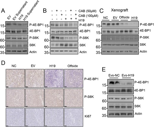 Exosomal H19 markedly inhibits 4E-BP1 phosphorylation. (A) The H19-overexpression medium inhibited phosphorylation of 4E-BP1 in GH3 cells. S6K and 4E-BP1 phosphorylation levels were detected by Western blot analysis. (B) The H19-overexpression medium and CAB worked together to further inhibit 4E-BP1 phosphorylation. S6K and 4E-BP1 phosphorylation levels were detected in the each group by Western blot. (C) H19 overexpression inhibited 4E-BP1 phosphorylation of the contralateral normal tumor. The expression levels of S6K and 4E-BP1 phosphorylation in the four groups were detected by Western blot. (D) The expression levels of S6K and 4E-BP1 phosphorylation in the four groups were detected by immunohistochemistry (scale bars, 100 μm). (E) In vivo experiment in which H19-overexpression exosomes inhibited 4E-BP1 phosphorylation of the normal tumor. The expression levels of S6K and 4E-BP1 phosphorylation in the two groups were detected by Western blot.
