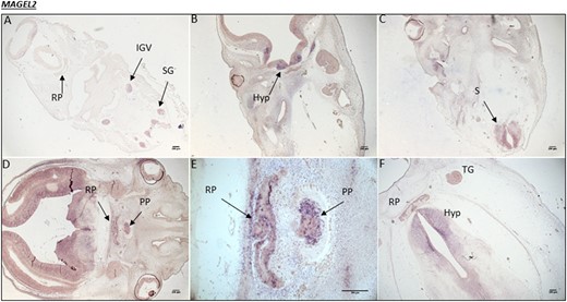 Human MAGEL2 expression during embryonic development. (A) CS16, the equivalent of 5.5 weeks into embryonic development. MAGEL2 expression is noted in the inferior ganglion of the vagus (IGV) nerve and the spinal ganglia (SG). (B) At CS19, 6 weeks into development, there are high levels of mRNA transcripts in the developing hypothalamus (Hyp), ventral diencephalon (VD), and (C) spinal cord (S). (D) At CS20, 7 weeks into development, strong transcript staining is present throughout the VD and in both the RP and PP. (E) A magnified image of the RP and PP from image (D). (F) At CS23, 8 weeks into development, MAGEL2 expression is maintained in the Hyp and RP, with some expression in the trigeminal ganglia (TG).