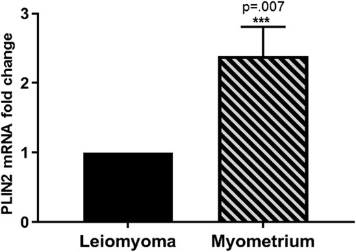 Relative PLIN2 mRNA levels in human leiomyoma tissue and matched adjacent myometrium. A total of 48 samples from 24 women were analyzed. To standardize comparisons between samples, PLIN2 expression in leiomyoma tissue was normalized to one. PLIN2 expression was 2.4-fold lower in leiomyoma compared with matched myometrium tissue (2.4 ± 0.51, mean ± SEM; ***P = 0.007 comparing myometrium with leiomyoma).