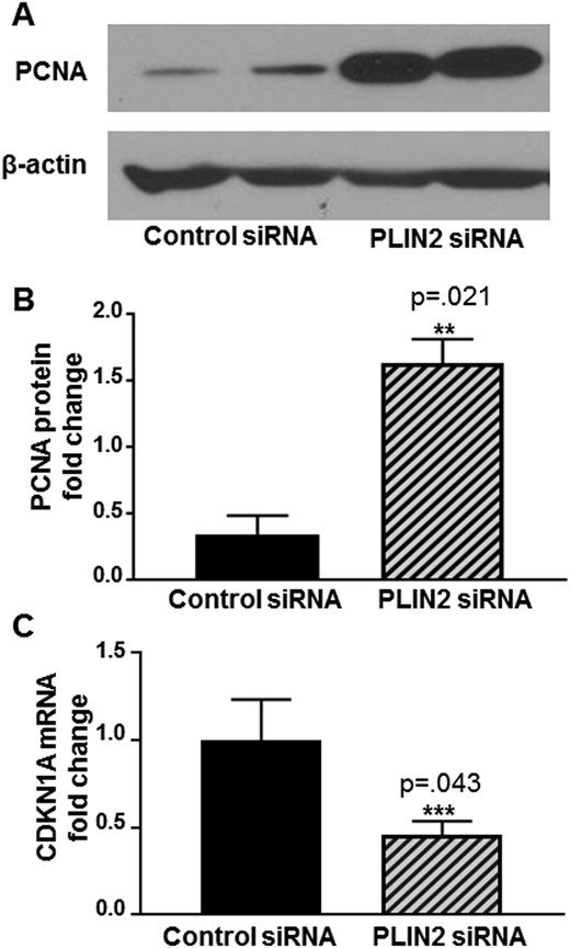 Effects of siRNA knockdown of PLIN2 on leiomyoma cell proliferation. Cell proliferation was determined by the measurement of PCNA protein levels using immunoblot. Blots were reprobed with a β-actin antibody as a loading control. (A) Representative immunoblot showing PLIN2 depletion led to increased PCNA protein expression. (B) Quantification of immunoblots from three independent patient samples demonstrating a 4.8-fold increase in PCNA protein levels (**P = 0.021; 1.63 ± 0.08 vs 0.34 ± 0.06, means ± SEM). (C) Leiomyoma cells were transfected with control siRNA or PLIN2 siRNA for 72 h. RT qPCR assay demonstrated a 0.46-fold decrease in CDKN1A mRNA levels in PLIN2-depleted vs control cells (***P = 0.043; 0.46 ± 0.08 vs 1.0 ± 0.23, mean ± SEM).