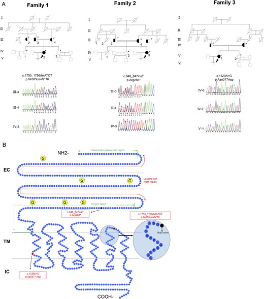 Family pedigrees of patients with infertility and LHCGR variants. (A) The pedigrees of families 1, 2, and 3. The arrows indicate the probands in families 1, 2, and 3. Sanger sequencing chromatograms are shown near the pedigrees. Solid symbols denote the affected subjects, open symbols denote unaffected subjects, half-solid symbols denote heterozygote subjects, and symbols with a slash denote persons who have died. Squares denote male family members, and circles denote female family members. The double line indicates consanguinity. Asterisks indicate the family members who underwent genetic testing. (B) Schematic representation of the LHCGR structure and location of the variants. LHCGR had a ligand-binding extracellular domain (EC) at the amino terminus and a transmembrane (TM) domain and an intracellular (IC) domain at the carboxyl tail. The EC domain contains the N-terminal cysteine-rich region, leucine-rich motif region, and hinge region. Three novel identified variants are demonstrated. The dark solid circle indicates the stop codon. The red solid circle indicates the replaced amino acid. The yellow hexagonal forms indicate the N-linked glycosylation sites.