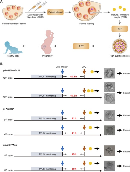 IVF treatment strategy for patients with pathogenic LHCGR variants. (A) The IVF treatment strategy for the patients with pathogenic LHCGR variants. IVM, in vitro maturation. (B) Typical IVF cycles of the patients with homozygous LHCGR variants performed using this strategy. The blue arrow indicates dual triggering, and the brown arrows indicate the times at which OPU occurred. The yellow solid circles indicate the retrieved oocytes. The time intervals between triggering and oocyte retrieval are shown between the blue and brown arrows.