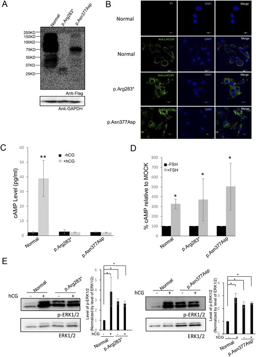 Expression and bioactivity of wild-type LHCGR and LHCGR variants in preovulatory granulosa cells. (A) Western blot detection of the expression of LHCGR and variants in granulosa cells from normal females and the probands in families 2 and 3. (B) immunofluorescence staining of LHCGR and variants in granulosa cells from normal females and the probands in families 2 and 3. Magnification ×600. White scale bar 20µm. (C) cAMP accumulation in response to hCG stimulation in granulosa cells from normal females and the probands in families 2 and 3. (D) cAMP accumulation in response to FSH stimulation in granulosa cells from normal females and the probands in families 2 and 3. (E) ERK phosphorylation in response to hCG stimulation in granulosa cells from normal females and the probands in families 2 and 3. *P < 0.05, **P < 0.01.
