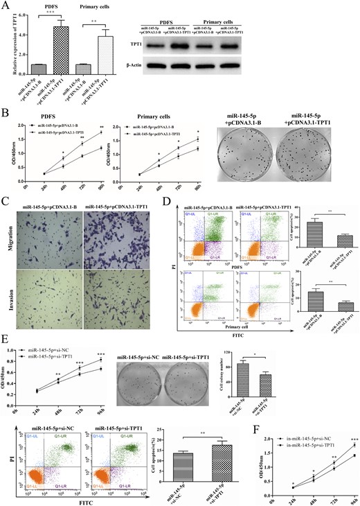 Repressing TPT1 blocked the tumor-suppressing effects of miR-145-5p. (A) Expression of TPT1 in cells cotransfected with miR-145-5p/pcDNA3.1-B and miR-145-5p/pcDNA3.1-TPT1. (B) Effect of TPT1 on miR-145-5p induced cell proliferation and colony formation. (C) Effect of TPT1 on miR-145-5p induced cell migration and invasion in vitro in Transwell chambers/Corning Matrigel Invasion Chambers. (D) Effect of TPT1 on miR-145-5p induced PDFS cell apoptosis by flow cytometry. (E) PDFS cells were cotransfected with miR-145-5p mimic and TPT1 siRNA; cells transfected with miR-145-5p mimic and siRNA-NC were set as the control. The effect of miR-145-5p was significantly enhanced when TPT1 was silenced. (F) Consistently, PDFS cells transfected with miR-145-5p inhibitor and TPT1 siRNA were significantly inhibited compared with those with miR-145-5p inhibitor and siRNA-NC. *P < 0.05, **P < 0.01, ***P < 0.001.
