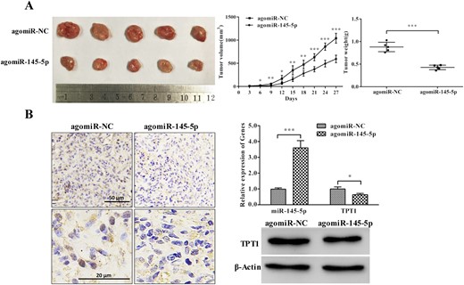 miR-145-5p inhibited PDFS cell tumorigenesis in vivo. (A) miR-145-5p inhibited PDFS cell proliferation and tumorigenesis in vivo. (B) Expression of miR-145-5p and TPT1 in miR-145-5p–expressing xenograft tumor tissues; immunohistochemistry assay confirmed significantly weaker staining of TPT1 in miR-145-5p–expressing xenograft tumor tissues. *P < 0.05, **P < 0.01, ***P < 0.001.