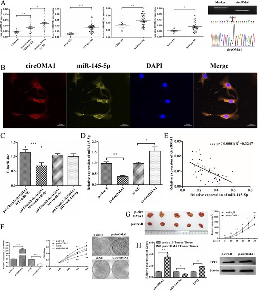circOMA1 acts as miR-145-5p sponge in NFPA cells. (A) Expression of circOMA1, hsa_circ_0000835, hsa_circ_0000825, and hsa_circ_0000994 were validated in 50 NFPA tissues and 15 NP tissues using qRT-PCR and normalized to that of glyceraldehyde 3-phosphate dehydrogenase. circOMA1 expression was also much greater in invasive tissues than in noninvasive ones. qRT-PCR product of circOMA1 was displayed in 1% agarose gel electrophoresis and was consistent with the sequence in circBase using Sanger sequencing. The red arrow indicates the back splicing site of circOMA1. (B) miR-145-5p colocalized with circOMA1 in cytoplasm was detected by fluorescence in situ hybridization. Scale bars represent 20 μm. (C) Relative luciferase activity of psiCHECK2-circOMA1-WT or psiCHECK2-circOMA1-MU cotransfected with miR-145-5p or miR-NC. Renilla luciferase activity was normalized to the Firefly luciferase activity. (D) Effect of circOMA1 on the expression of miR-145-5p. (E) Correlation analysis between circOMA1 and miR-145-5p. (F) Effect of circOMA1 on cell proliferation and colony formation ability of PDFS cells. (G) circOMA1 promotes cell proliferation and tumorigenesis in vivo. (H) Expression of circOMA1, miR-145-5p, and TPT1 in circOMA1-expressing xenograft tumor tissue. *P < 0.05, **P < 0.01, ***P < 0.001.