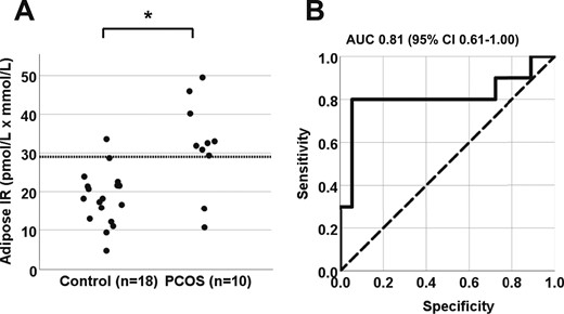 (A) Differences in adipose-IR between normal-weight women with PCOS (n = 10) and control subjects (n = 18; P = 0.007). Adipose-IR is defined as the product of fasting circulating insulin (pmol/L) and total fatty acid (mmol/L) levels. (B) Receiver operating curve for adipose-IR. An adipose-IR value of 29 pmol/L × mmol/L provided 95% specificity and 80% sensitivity in discriminating between women with PCOS and control subjects (P < 0.001). AUC, area under the curve.