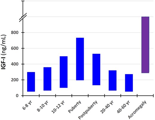 Serum concentrations of IGF-I (10th and 90th percentiles) in different age groups of healthy subjects and untreated patients with acromegaly at diagnoses. Note the overlapping of IGF-I values between the normal pubertal subjects and patients with acromegaly.