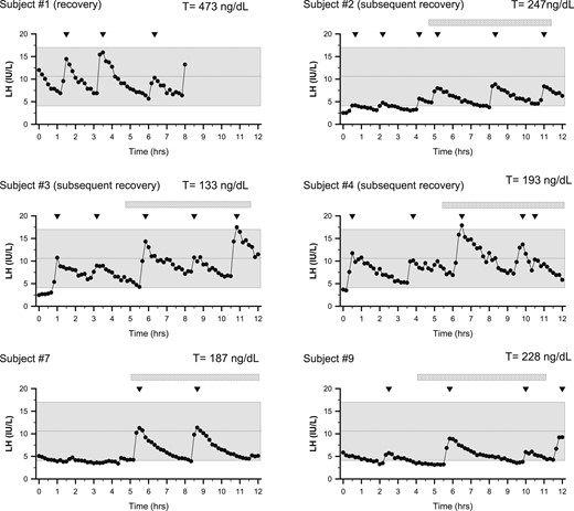 Spectrum of LH secretion patterns of men presenting with FHH. Subjects underwent detailed neuroendocrine profiling (every 10 minutes × 12 hours) to chart LH secretion pattern. Inverted triangles depict LH pulses. Shaded region depicts the normal reference range (27). Subject 1 underwent only 8 hours of sampling and had recovered HPG axis function at the time of the neuroendocrine evaluation (normal serum T levels).