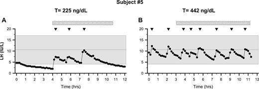 Recovery from functional hypogonadotropic hypogonadism. Subjects underwent neuroendocrine profiling (every 10 minutes × 12 hours) to chart GnRH-induced LH secretion. (A) Patient 5 exhibited nocturnal sleep-entrained LH pulses and hypogonadal serum T (225 ng/dL, 7.8 nmol/L). (B) After weight gain, repeat frequent sampling showed normal LH pulse frequency and amplitude with normal serum T (442 ng/dL, 15.3 nmol/L). Note: The study was stopped at 11 hours of sampling because of a problem with the IV. Shaded region represents the normal reference range (27). Inverted triangles indicate LH pulses. The hatched bars depict periods of sleep.