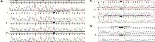 Sequencing data of DLK1 gene showing 3 rare allelic variants. (A) DLK1 deletion c.401_404 + 8del identified in patient 1 (index case): I, index; II, father; III, mother; IV, sister; all of them were wildtype. (B) Patient 2 with the synonymous DLK1 c.402C>T p.Asn134= (rs150016759): I, index case; II, father; III, mother wildtype. (C) Patient 3 with DLK1 promoter region alteration g.-222 C>A and g.-223 G>A. I, control; II, index case.