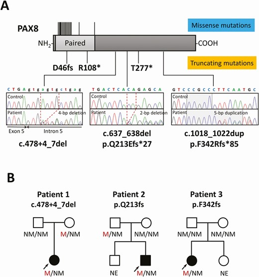 Identification of 3 novel truncating PAX8 mutations. A, A schematic diagram of the PAX8 protein and electropherograms of each mutation-carrying patient are shown. The deleted nucleotides are shown by dashed lines and the duplicated nucleotides are shown by the shaded area. The location of previously described mutations is indicated by the black lines (upper, missense mutations; lower, truncating mutations) B, Pedigrees of the 3 mutation-carrying patients. Black symbols indicate individuals affected with congenital hypothyroidism. M, mutated; NE, not evaluated; NM, not mutated.