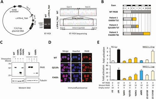 Characterization of the 3 truncating PAX8 mutations. A, A schematic diagram of the PAX8-expressing plasmid that contains the full genomic sequence corresponding exons 4 to 7 (left panel). Reverse transcriptase–polymerase chain reaction (RT-PCR) showed a slightly larger PCR product in mutant-expressing cells (middle panel). Sequencing of the RT-PCR product showed an insertion of a 34-bp sequence between exons 5 and 6 (right panel). B, Schematic diagrams of wild-type (WT)-PAX8 and the 3 truncating mutants identified in this study. C, Images of Western blotting are shown. The protein expression level of I160fs-PAX8 was low (left), which was partially recovered by a proteasome inhibitor MG132 (right). D, Subcellular localization analysis showed comparable localization of WT-PAX8 and 2 mutants. The scale bars indicate 10 μm. E, The upper panel shows the transactivation assays with no coexpression of NKX2-1. I160fs-PAX8 was nonfunctional, whereas Q213fs-PAX8 and F342fs-PAX8 had residual activities. The lower panel shows transactivation assays with coexpression of NKX2-1. Recovery of transactivation capacity (“rescue”) was observed in Q40P-PAX8. This “rescue” was not observed in Q213fs-PAX8, F342fs-PAX8, or ΔEx10-12-PAX8. The data are representative of 3 independent experiments with similar results. Bars indicate SEM.