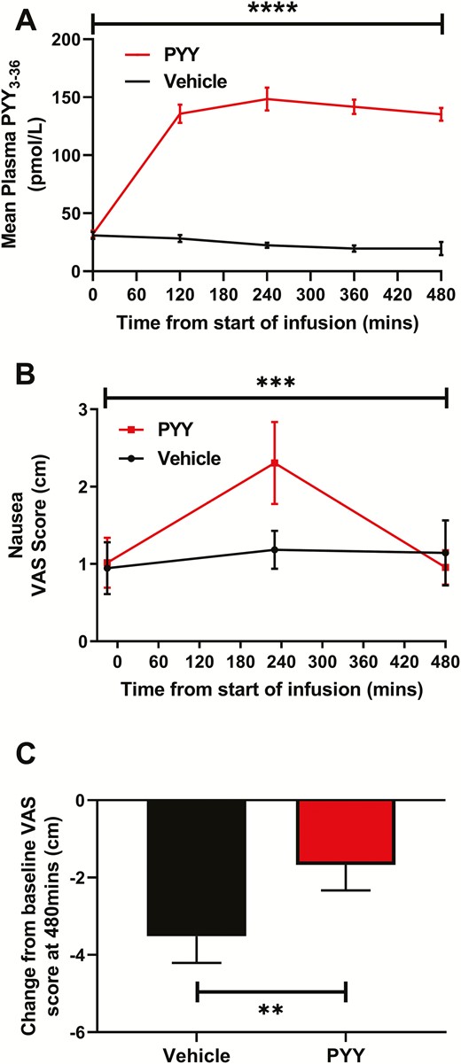 Effects of intravenous peptide YY (PYY) administration (0.4 pmol/kg/min PYY3-36 for 8 hours) on plasma PYY levels, nausea and fullness in 18 healthy men. (A) PYY infusion resulted in significantly higher plasma PYY levels compared to vehicle infusion (generalized estimating equation (GEE), ****P < .0001). (B) Self-reported nausea, measured using a 0–10 cm visual analog scale (VAS), was increased by PYY infusion compared to vehicle infusion (generalized estimating equation (GEE), ***P < .001). C: Self-reported fullness, measured using a 0–10 cm visual analog scale (VAS), reduced by a lesser extent at T = 480 minutes during PYY infusion compared with vehicle infusion (Wilcoxon matched-pairs signed rank test, **P = .01).